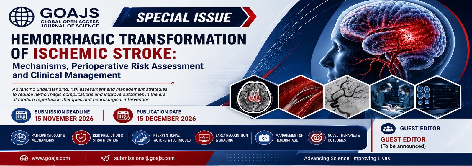 Hemorrhagic Transformation of Ischemic Stroke: Mechanisms, Perioperative Risk Assessment and Clinical Management